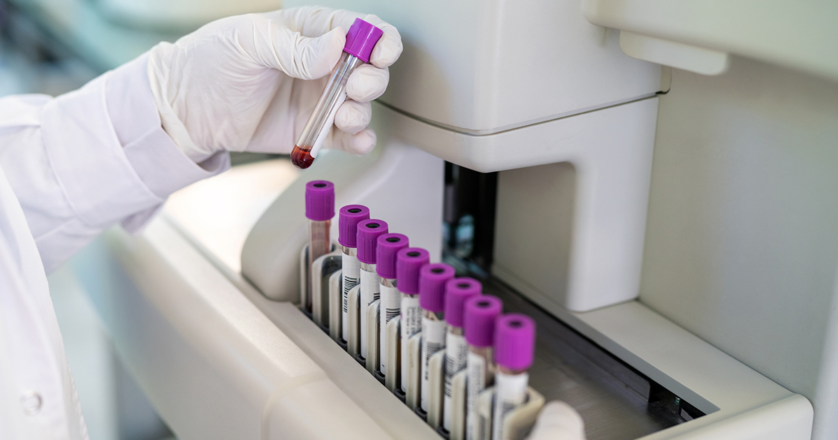 Will Offering a Blood Test to Detect Lung Cancer Improve Screening Rates?