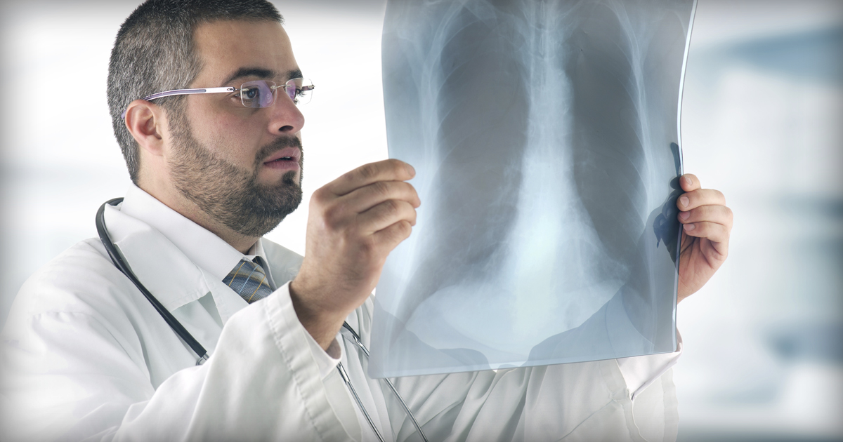 Radiation Therapy for Lung Cancer | American Lung Association